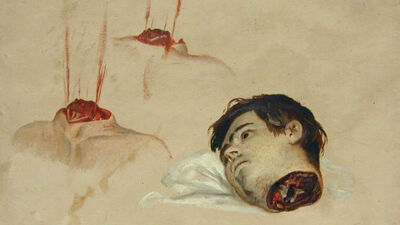 Antoine Wiertz: Afgehakt hoofd.