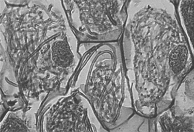 orchid mycorrhiza