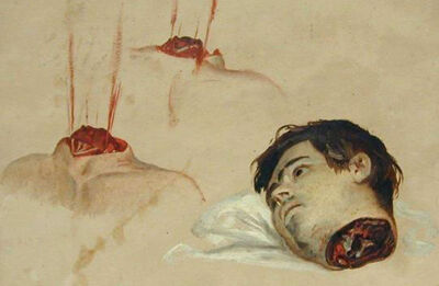 Antoine Wiertz: Afgehakt hoofd.