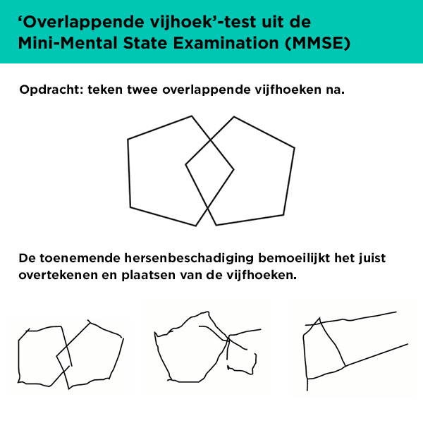 tekentest uit de MMSE