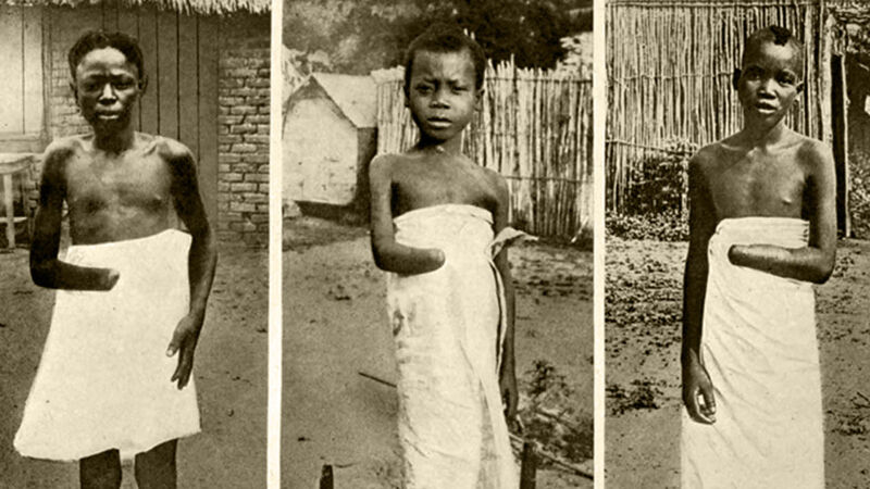 Verminkte kinderen. Foto's gebruikt door Mark Twain in zijn pamflet tegen Leopold II (1905)