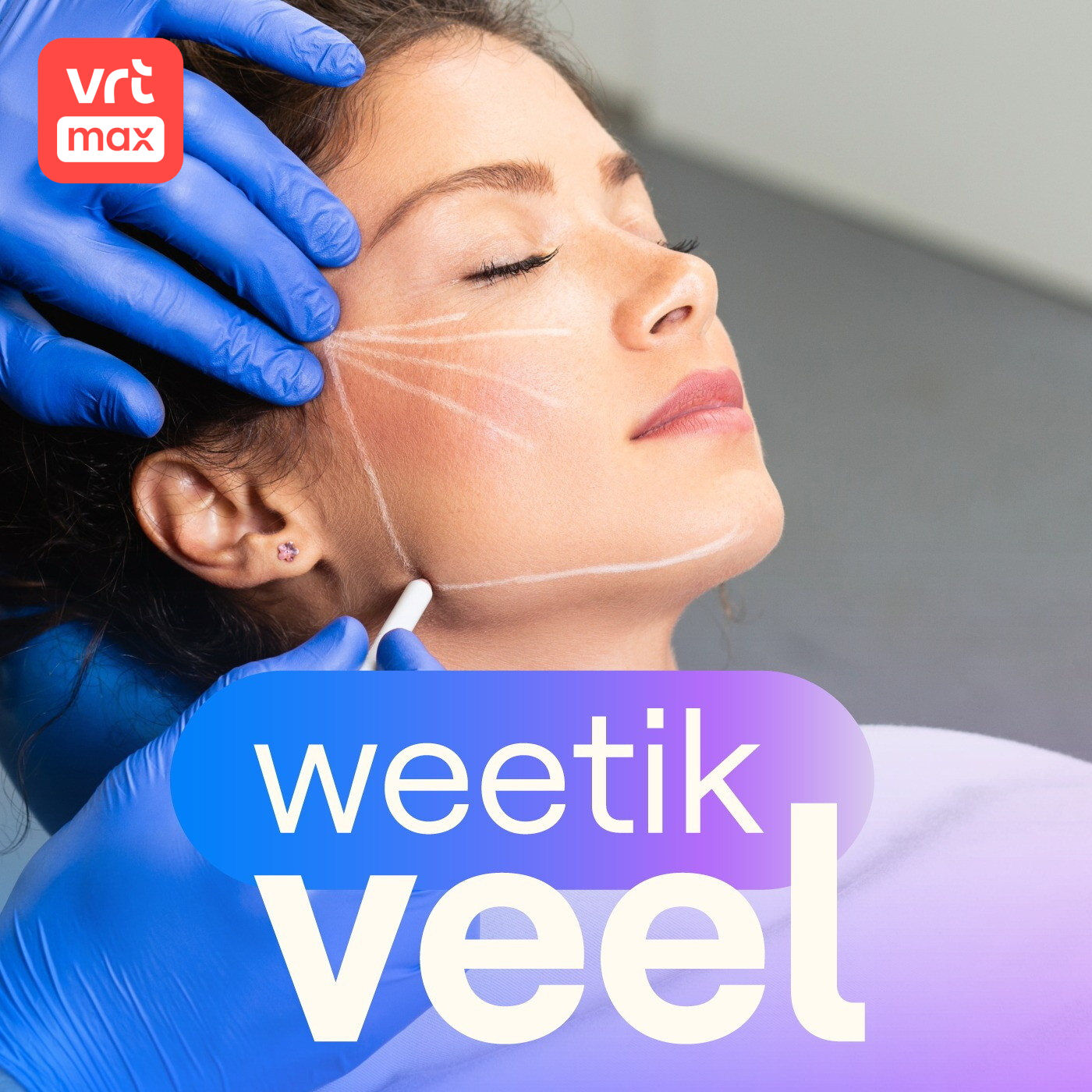 Plastische chirurgie