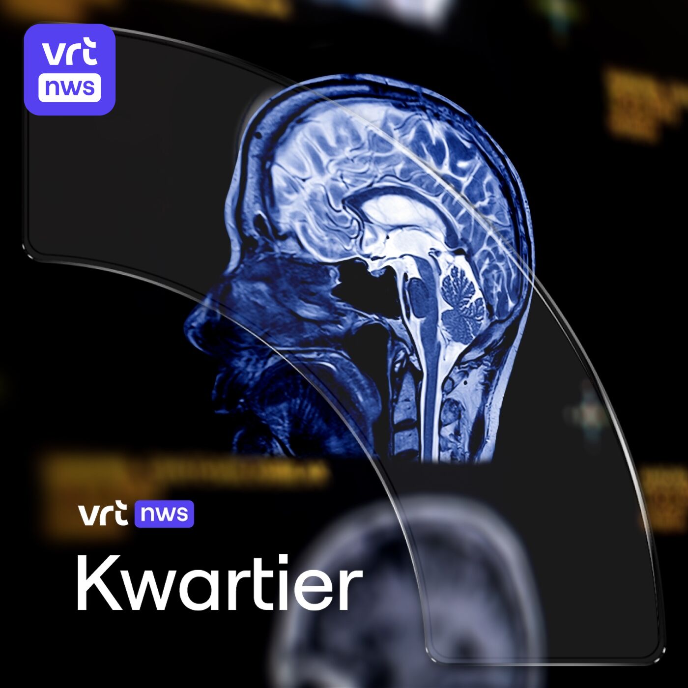 Kan je een hersenbloeding voorkomen? Spanning in West-Afrika en warme december Kan je een hersenbloeding voorkomen? Spanning in West-Afrika en warme december