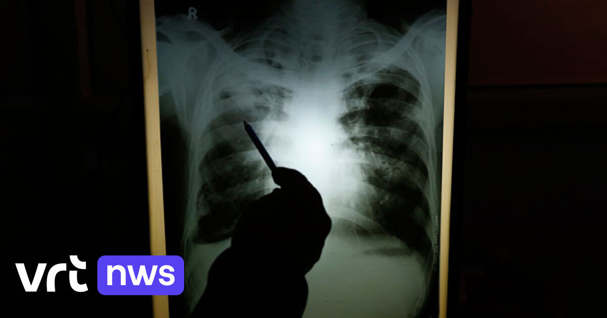 Damien Foundation warns of an increase in tuberculosis in our country