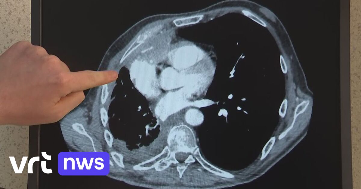 how-long-can-a-cat-live-with-skin-cancer