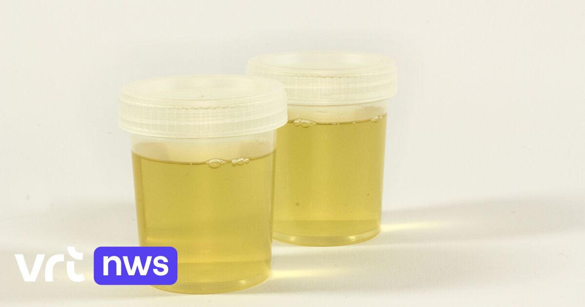 Hasselt University discovers way to preventively detect age-related diseases with urine samples