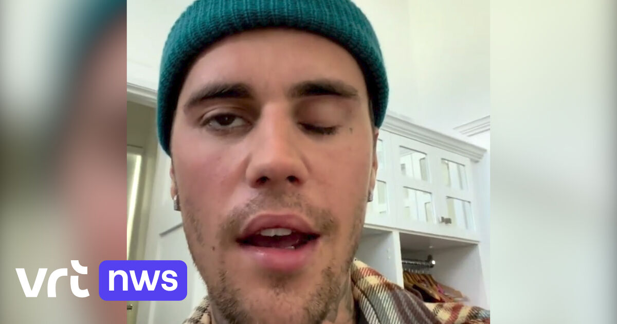 Ramsay-Hunt Syndrome: Here’s what you need to know about the infection paralyzing Justin Bieber’s face