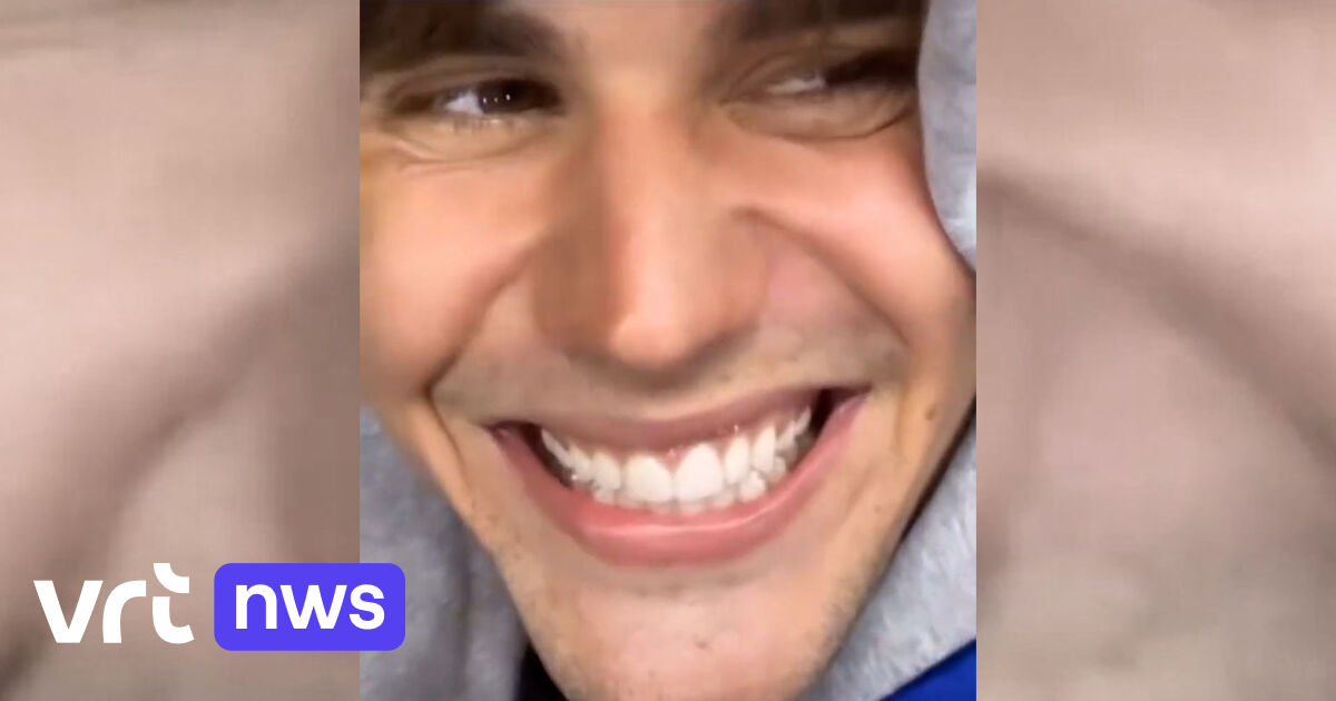 Facial Paralysis is No Longer a Hurdle for Justin Bieber’s Smile