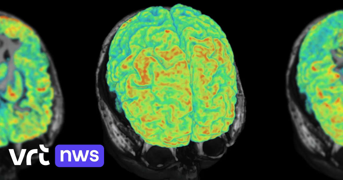 Weltweit erster Einsatz bei der Uniklinik Löwen: Hirnscanner kann bei der Früherkennung von Alzheimer oder Parkinson helfen