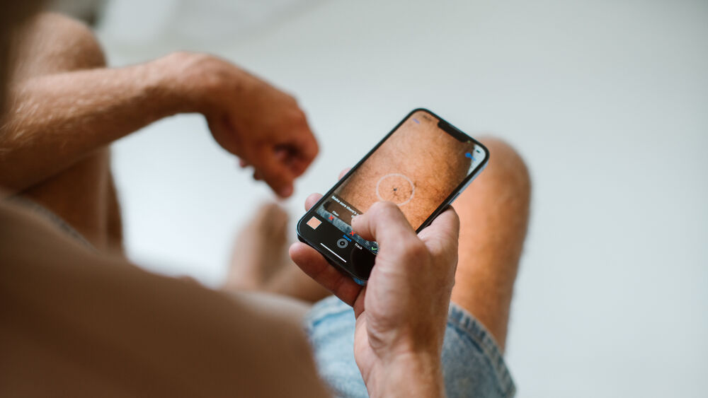 Foto De app heeft moeite met behaarde zones. Marie Broeckman