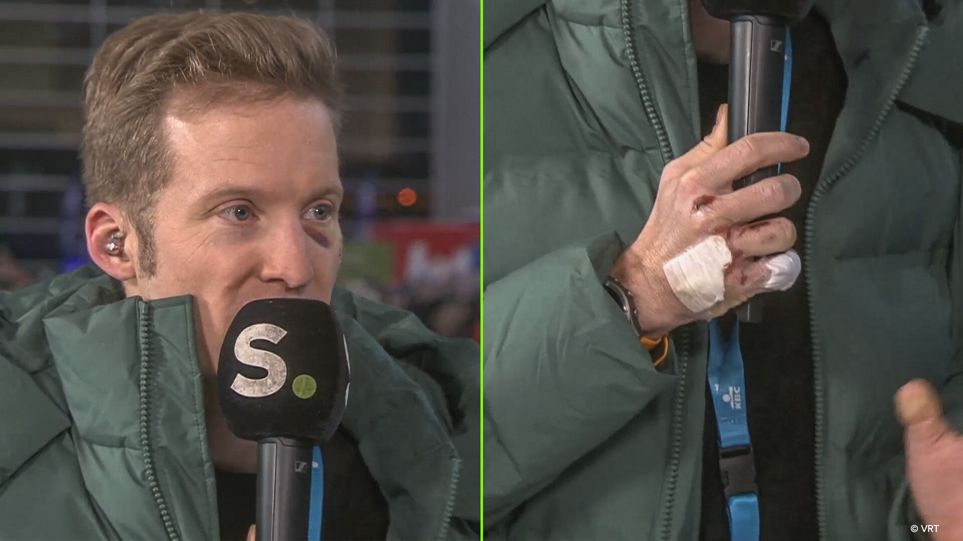 Jan Bakelants (met gehavende handen) "voelt zich beter" na aanrijding: "Schrikwekkend om me niets te herinneren"