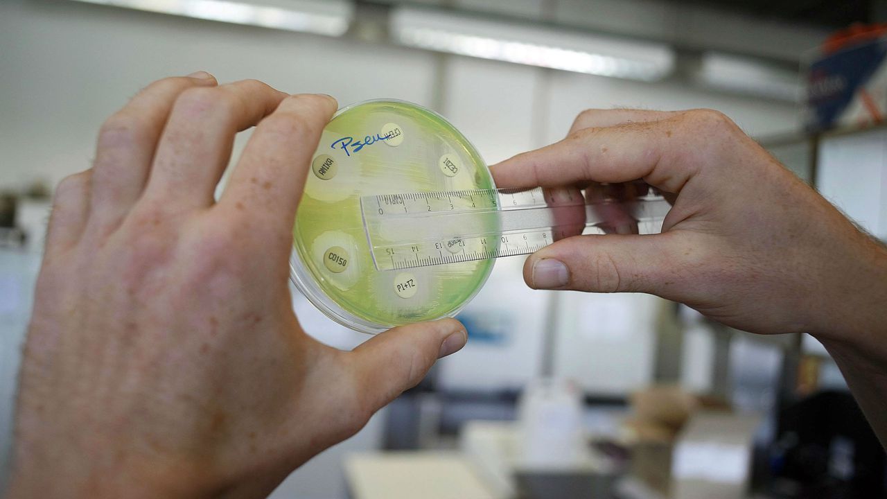 Une nouvelle méthode pour tuer les bactéries résistantes aux antibiotiques VRT NWS le site d