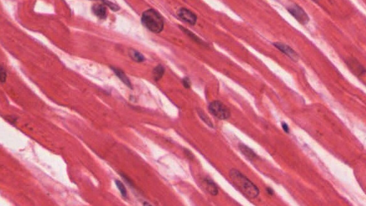 Заболевания мышечной ткани. Мышечная клетка под микроскопом. Тигролиз кардиомиоцитов. Кардиомиоцит 3д. Cardiomyocyte Histology typicaд Pacemaker.
