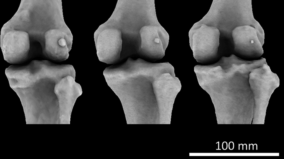 De terugkeer van de fabella, "de appendix van het skelet": het botje