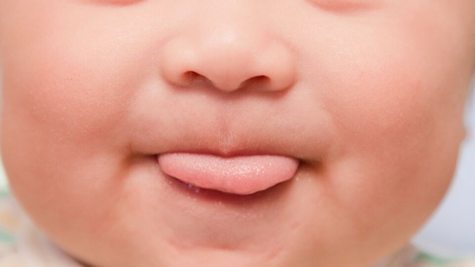 Knippen we te snel tongriempjes van baby’s of kleine kinderen? "Vaak